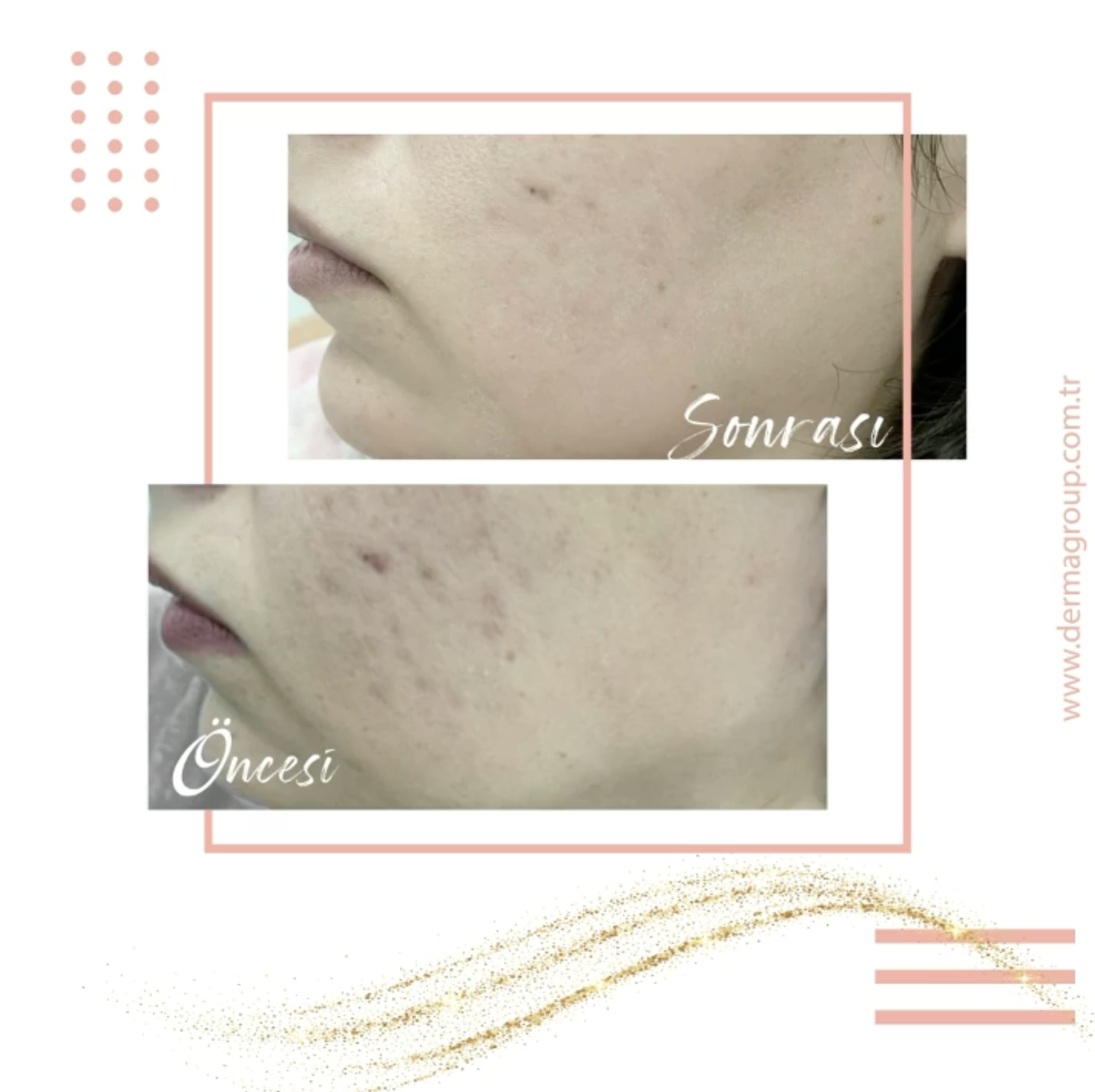 Derma Turkish Derma Group – Yeni bir sen!
